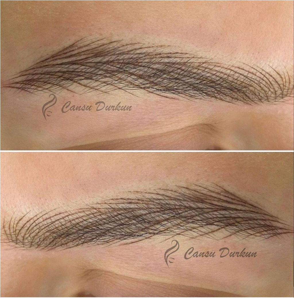 عکس فیبروز ابرو