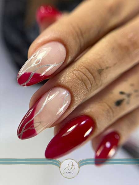 کاشت فرنچ در کرج