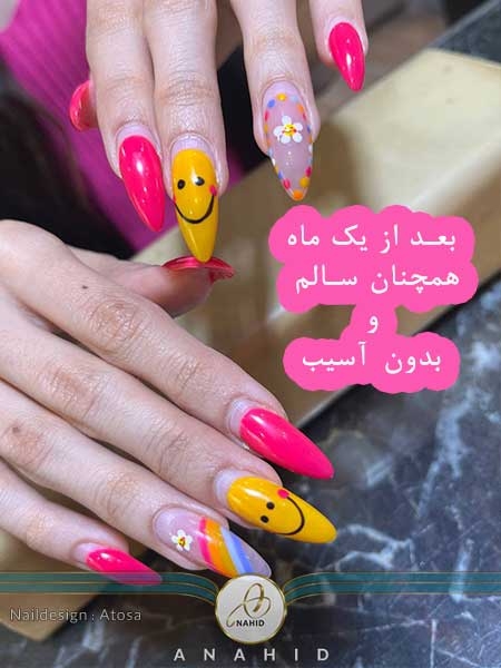 کاشت ناخن اسمایلی در کرج بعد از 4 هفته