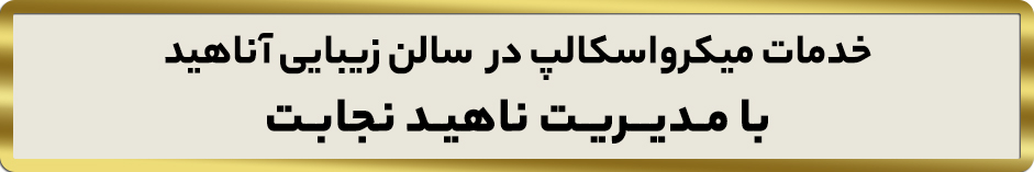 میکرواسکالپ در کرج و تهران