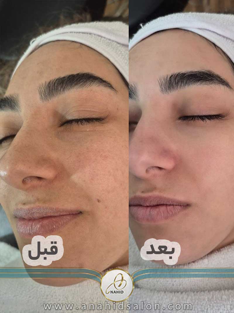 گالری پاکسازی پوست