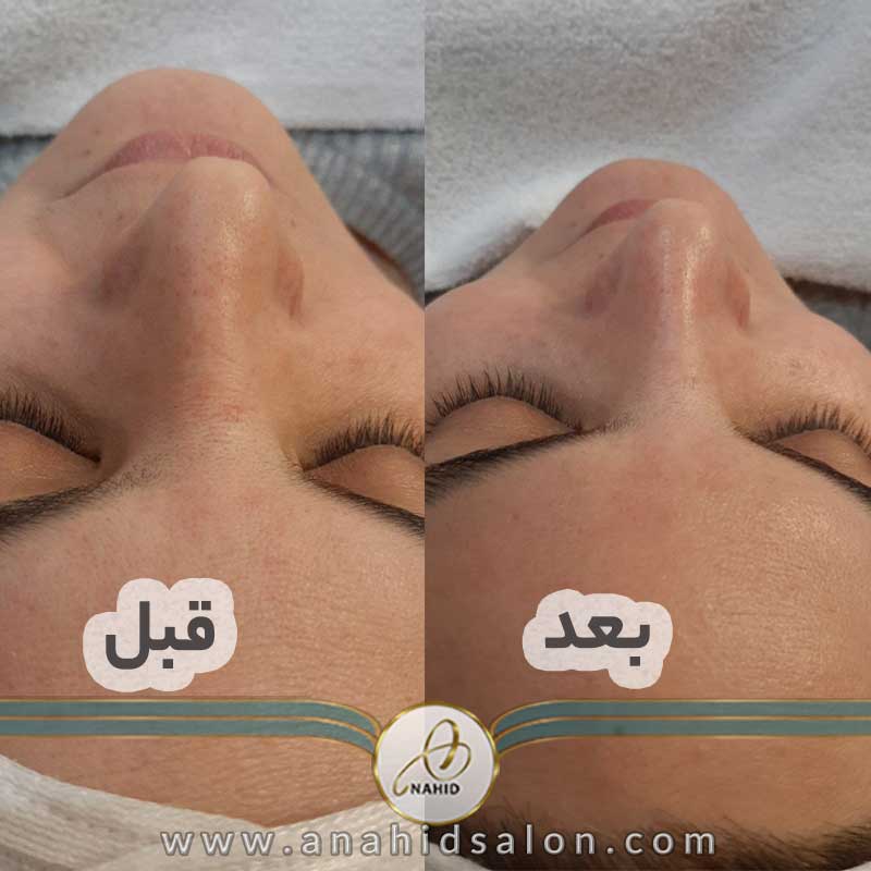 گالری پاکسازی پوست