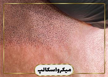 گالری میکرواسکالپ