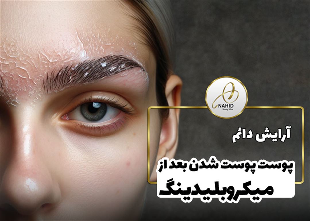 پوسته پوسته شدن میکروبلیدینگ و فرآیند بهبودی آن