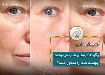 12 کرم شب عالی برای شما