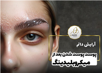 پوسته پوسته شدن میکروبلیدینگ و فرآیند بهبودی آن