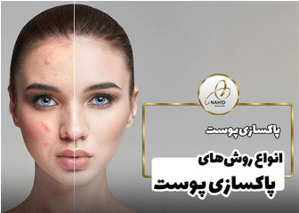 انواع روش های پاکسازی پوست