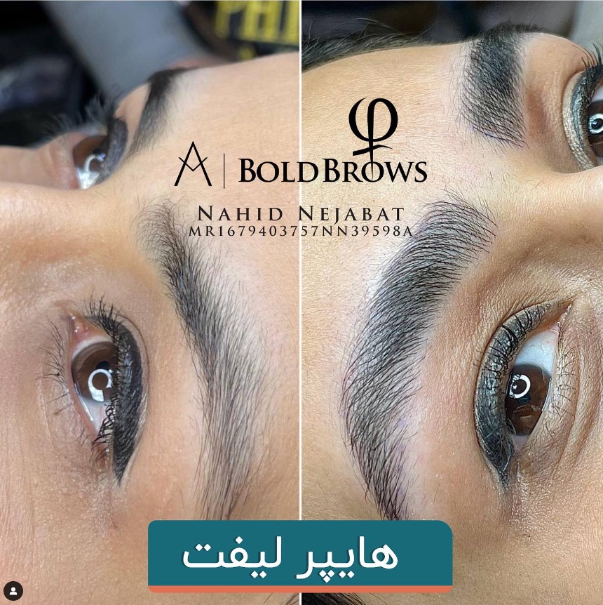 مراحل بهبودی میکروبلیدینگ ابرو