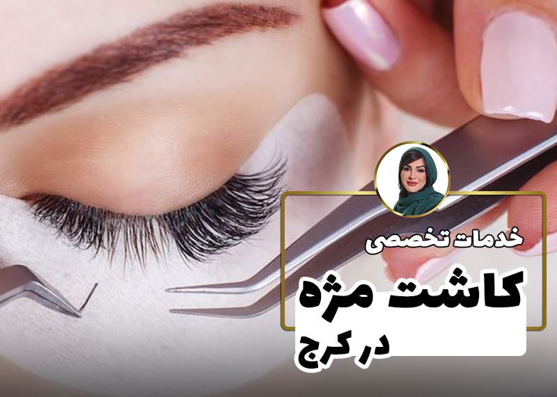 کاشت مژه در کرج