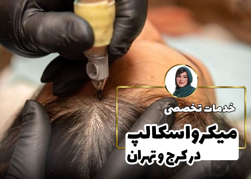 اسکالپ کف سر (میکرواسکالپ مو)