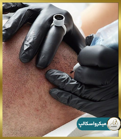 نمونه کار اسکالپ مو